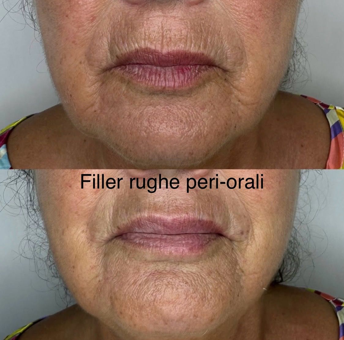 Raffaela Esposito-12