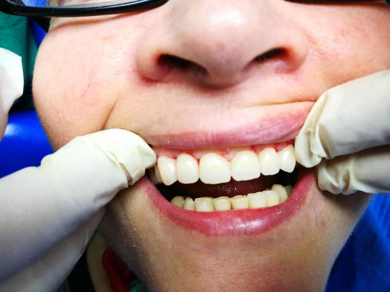 Stefano De Simone-22