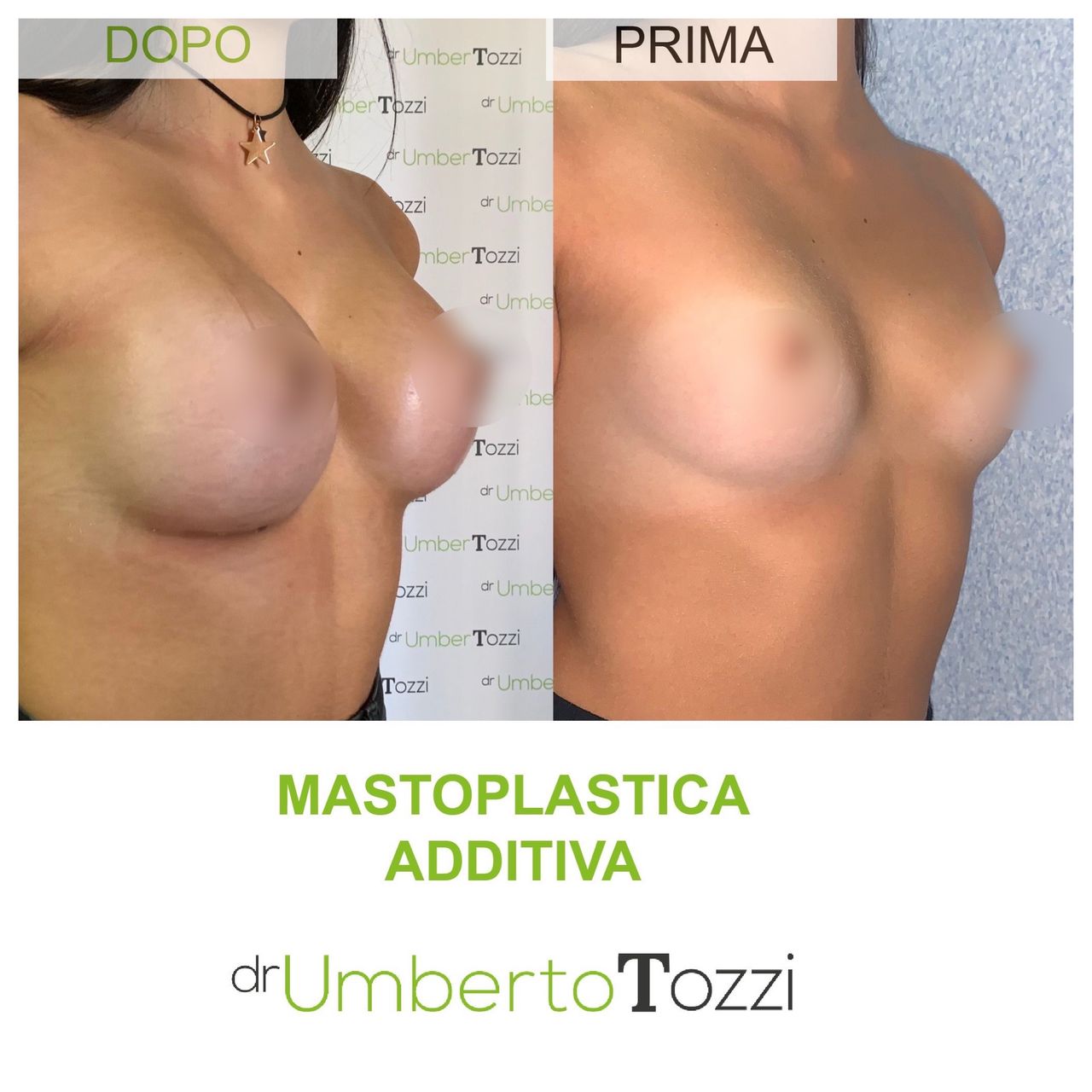Umberto Tozzi-11
