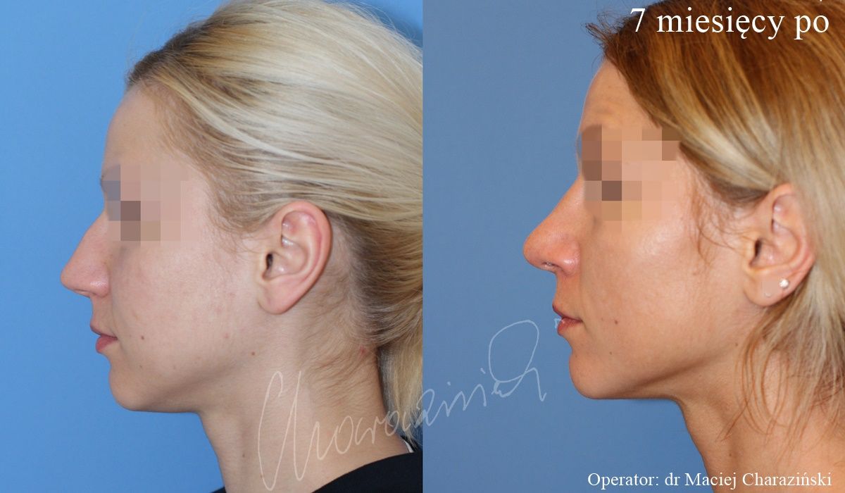 Maciej Charaziński-33