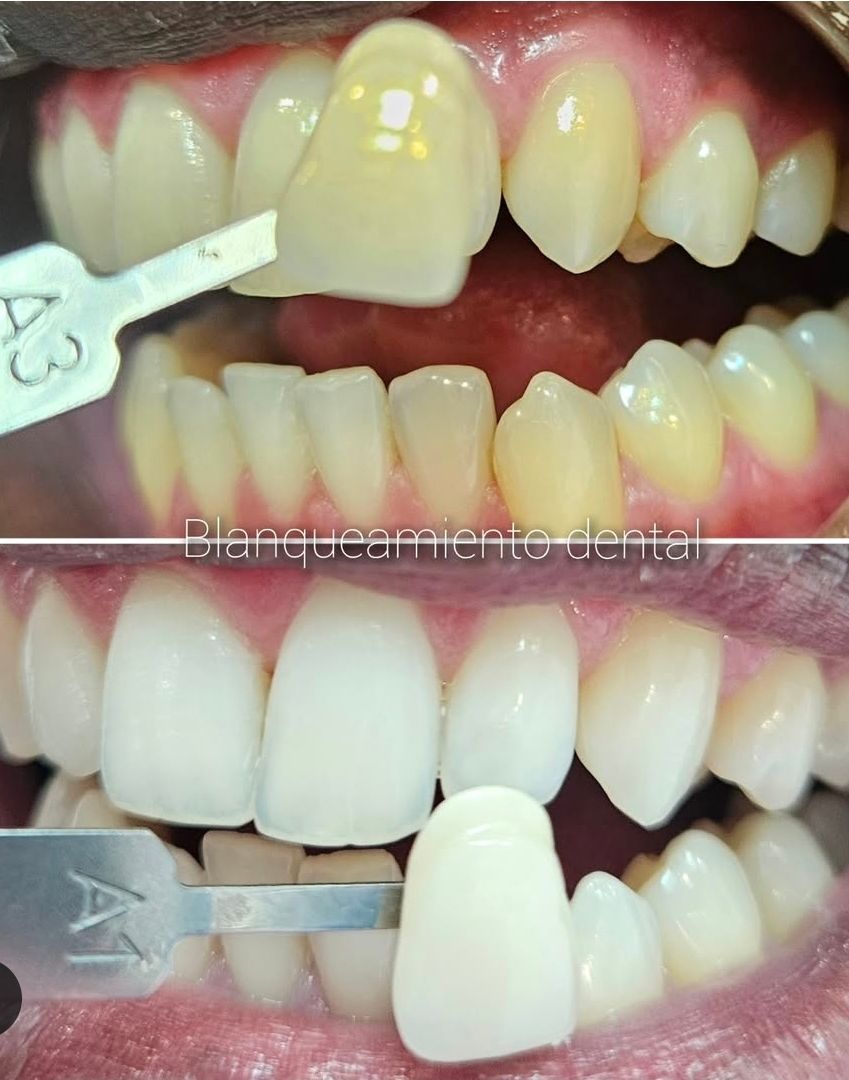 Liset Sánchez De Hombre-0