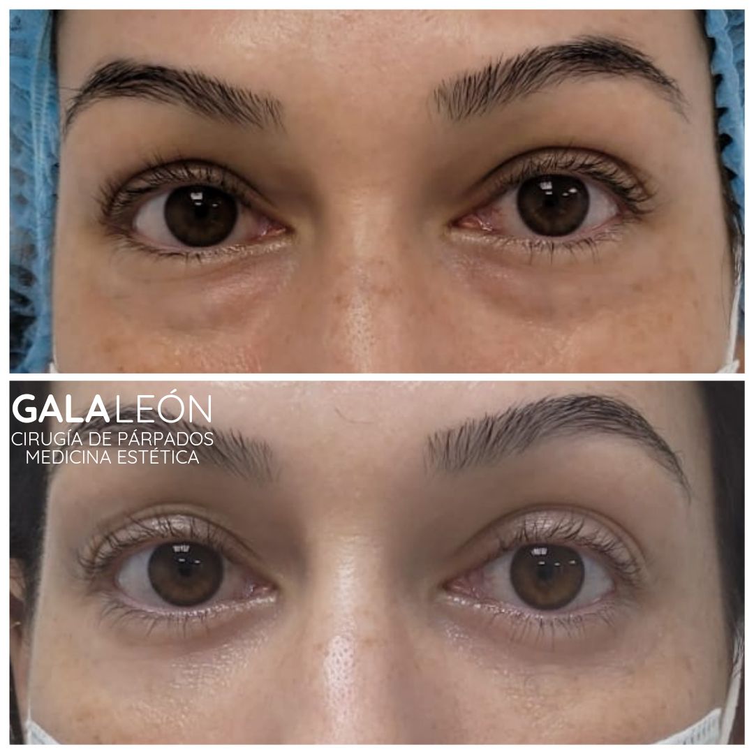 Gala P. Leon Salvatierra-21