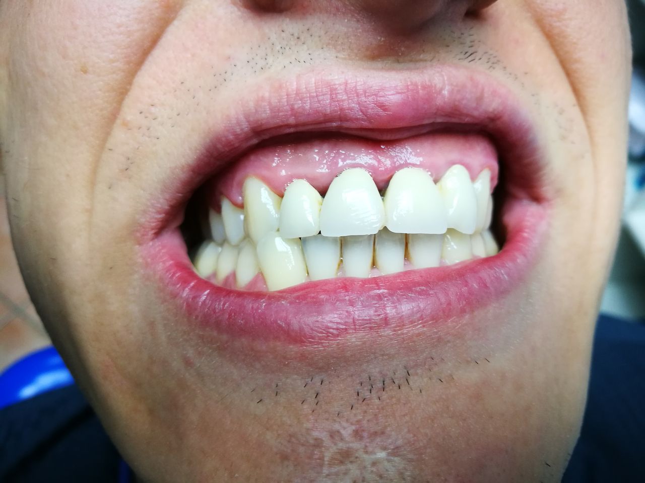 Stefano De Simone-10