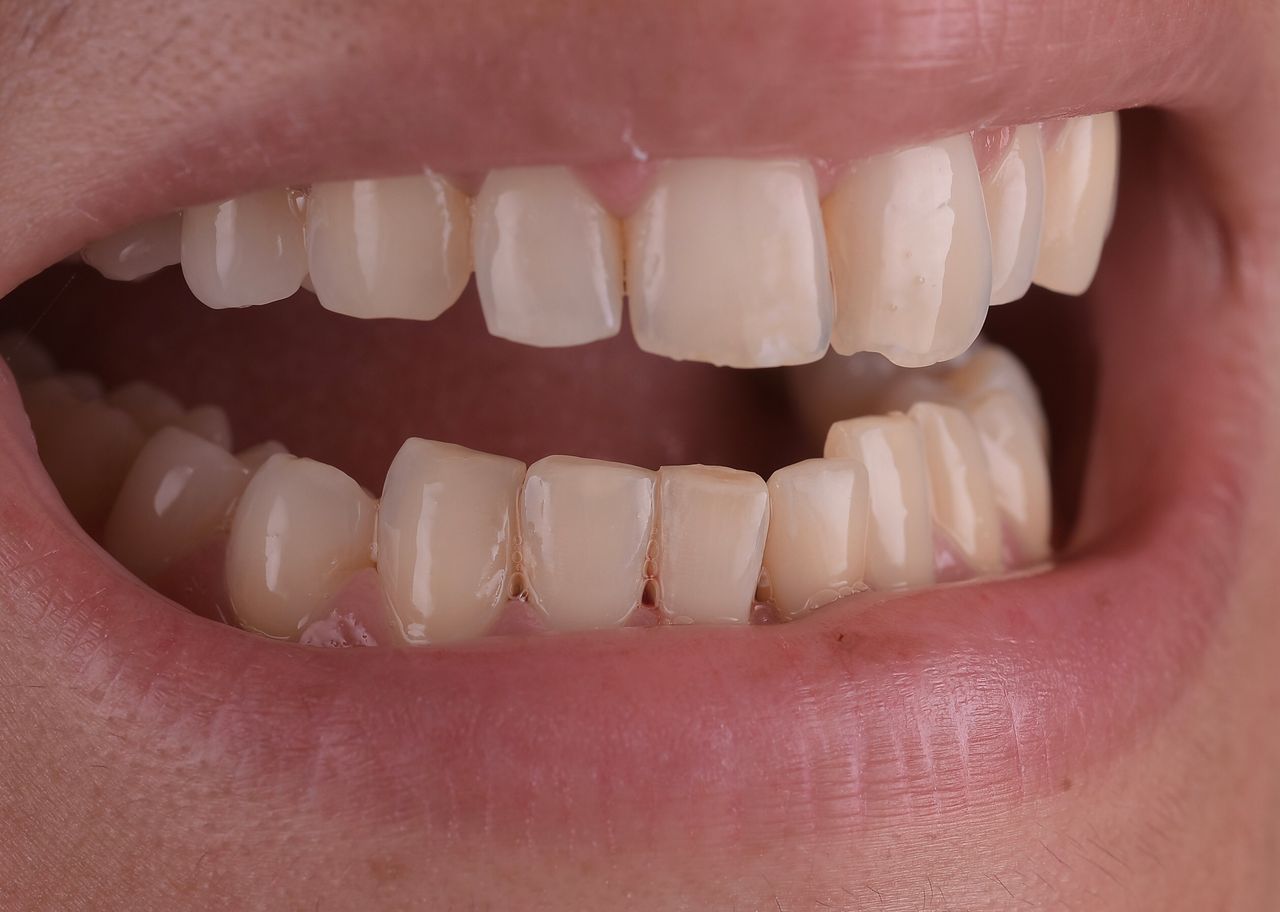 Riccardo Giardina-66