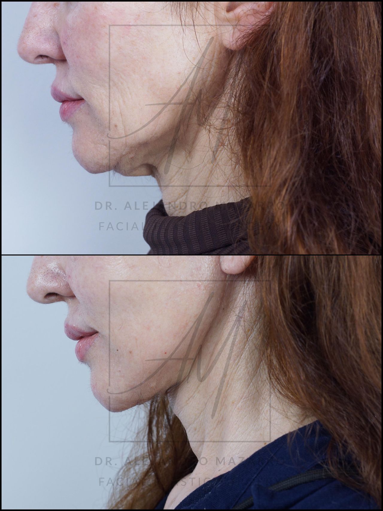 Alejandro Mazarro Campos-6