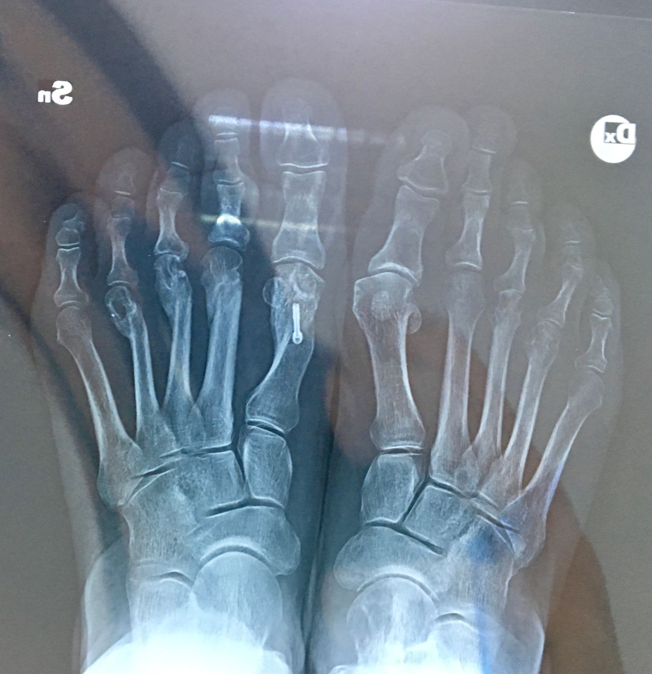 Alberto Maria Bonifazi-9