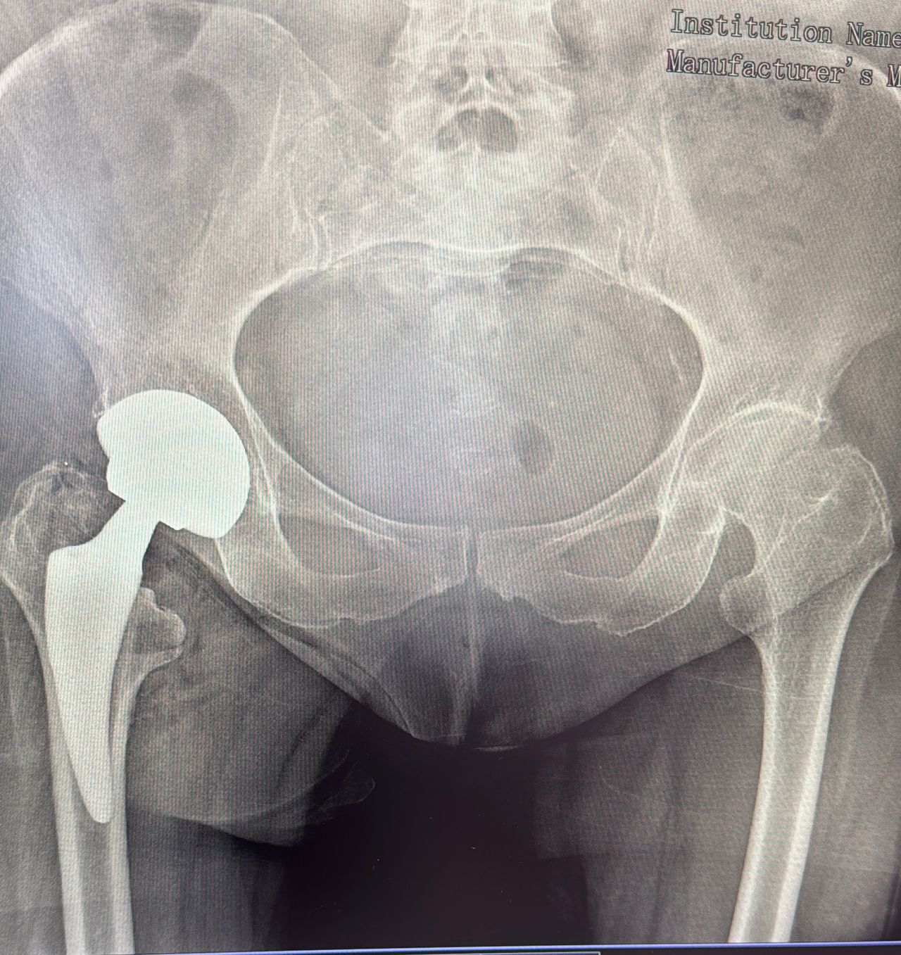 Pieralberto Valpiana-5