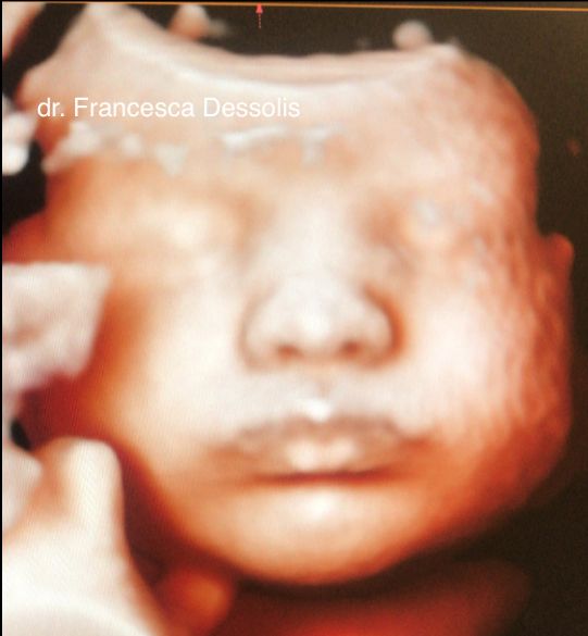 Francesca Dessolis-3