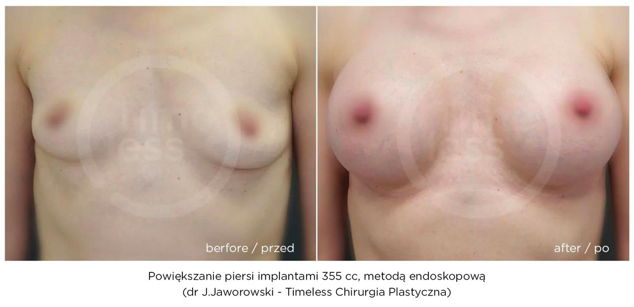 Janusz Jaworowski-118