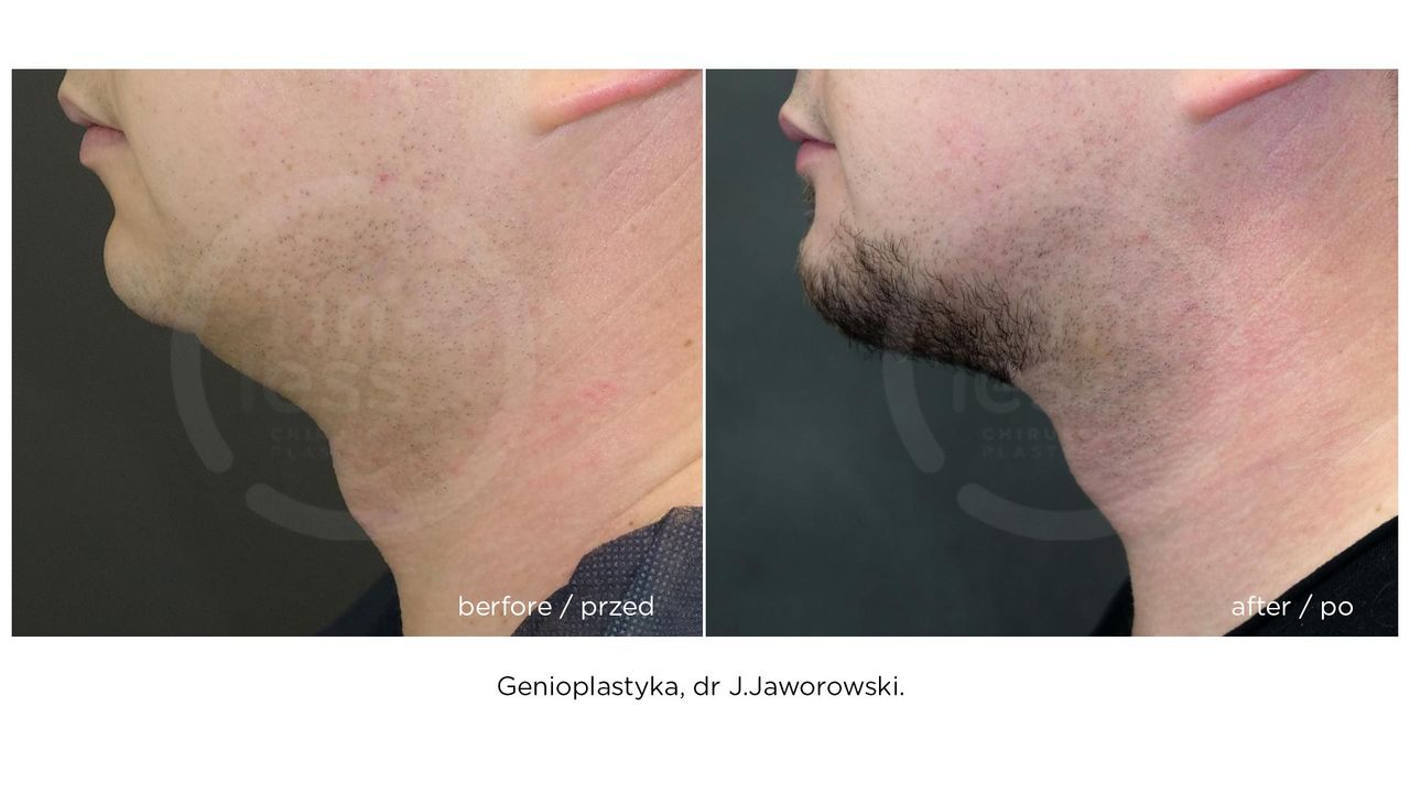 Janusz Jaworowski-65