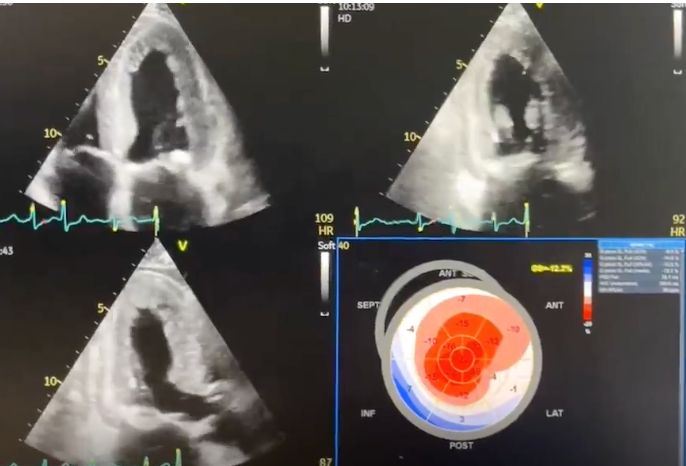Salvatore Chianese-0