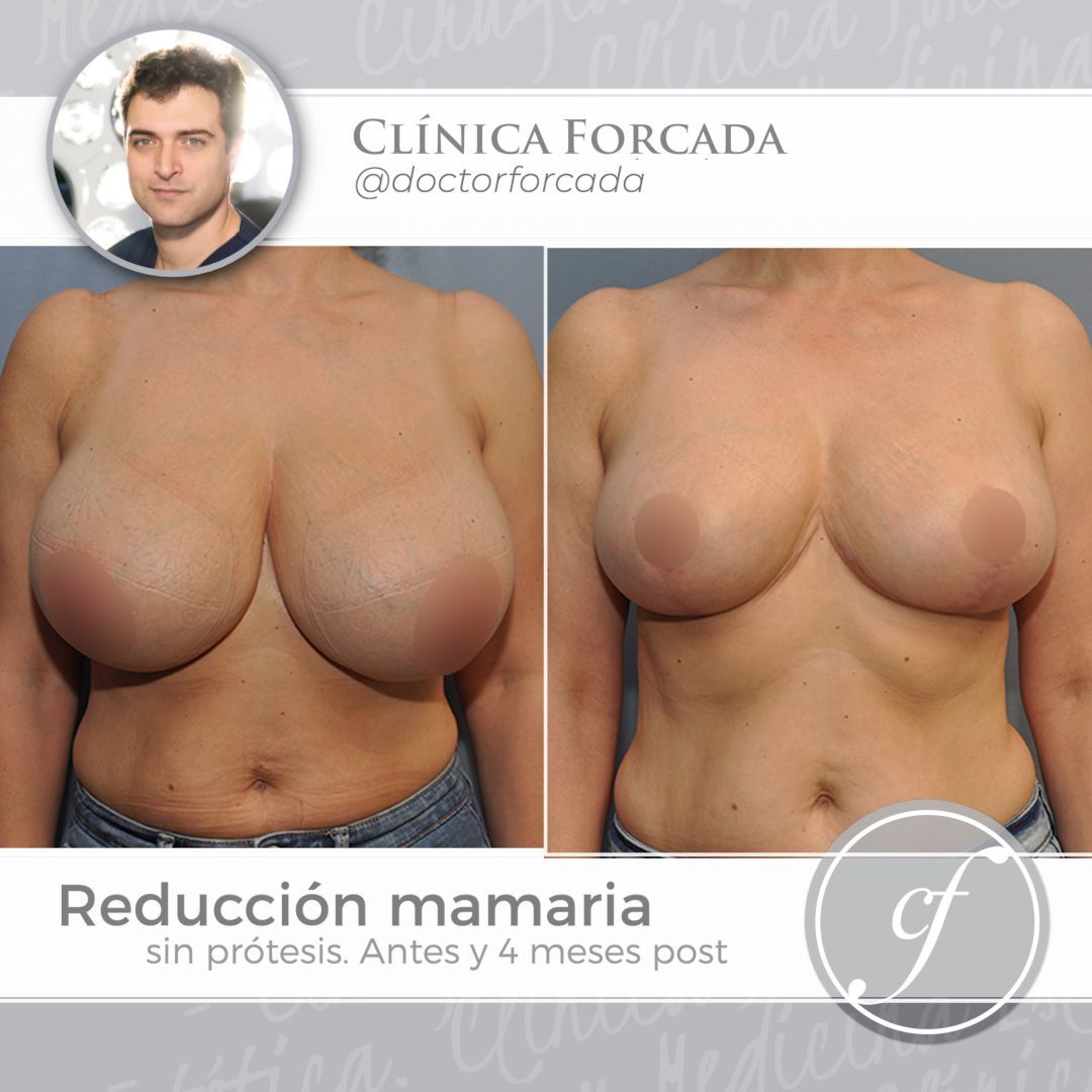 Eduardo Forcada Melero-12