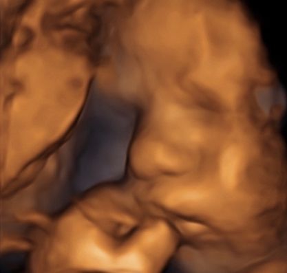 Karolina Panek - Laszczyńska-4