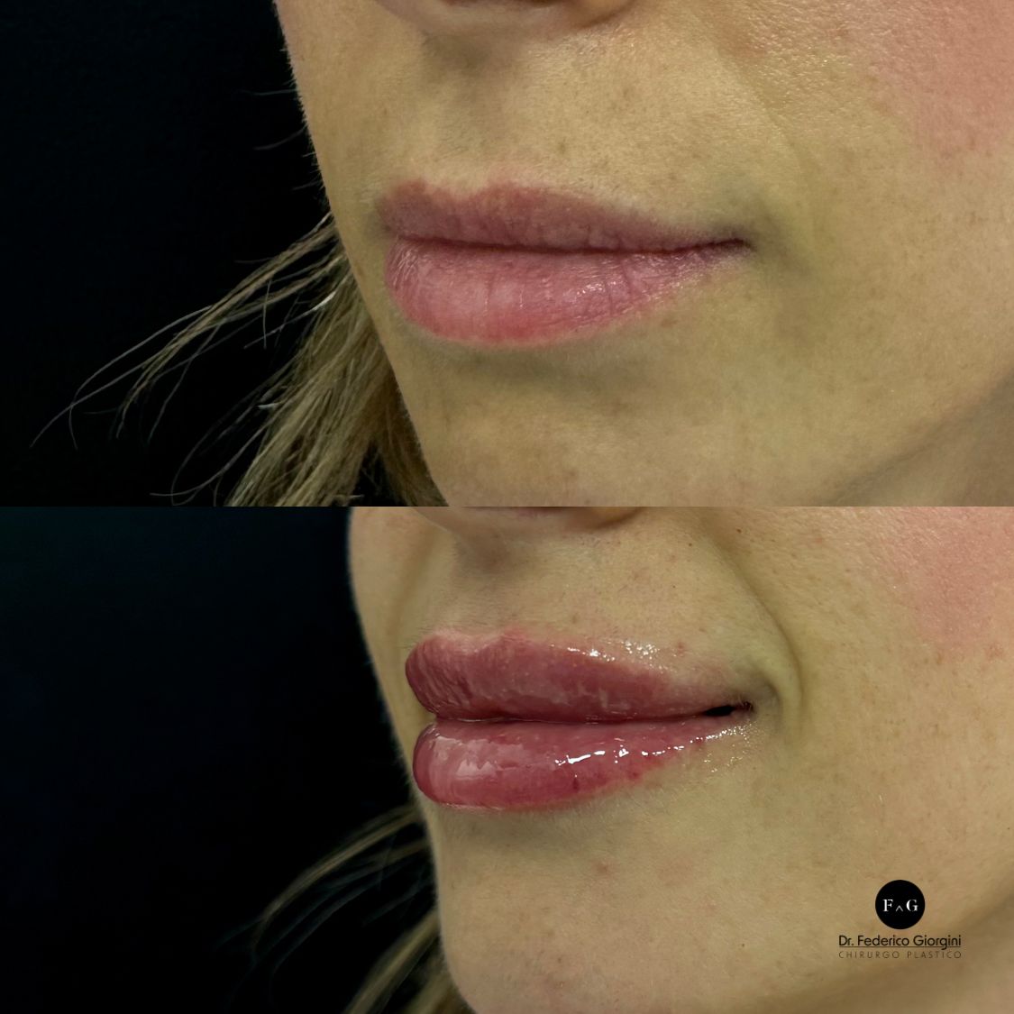 Federico Giorgini-17