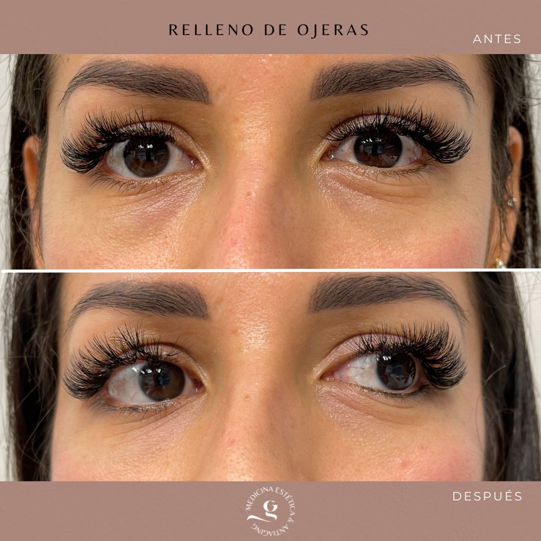 ​Giovanni Giorgianni-35