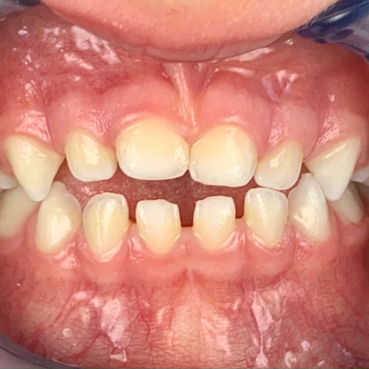 Gianluigi Bittante-44