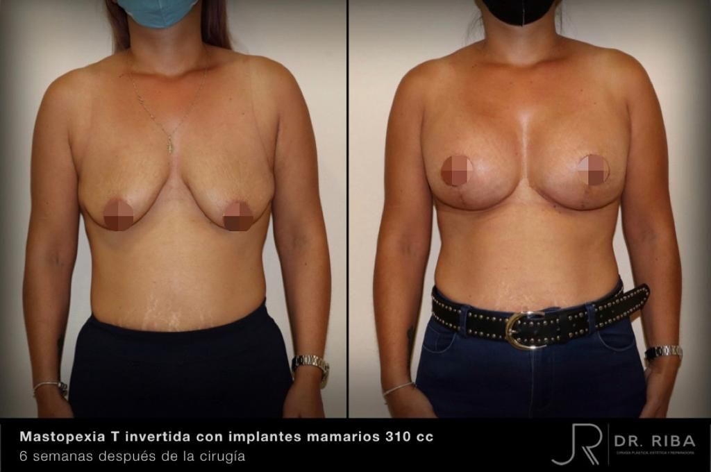 Jordi Riba Vilchez-43