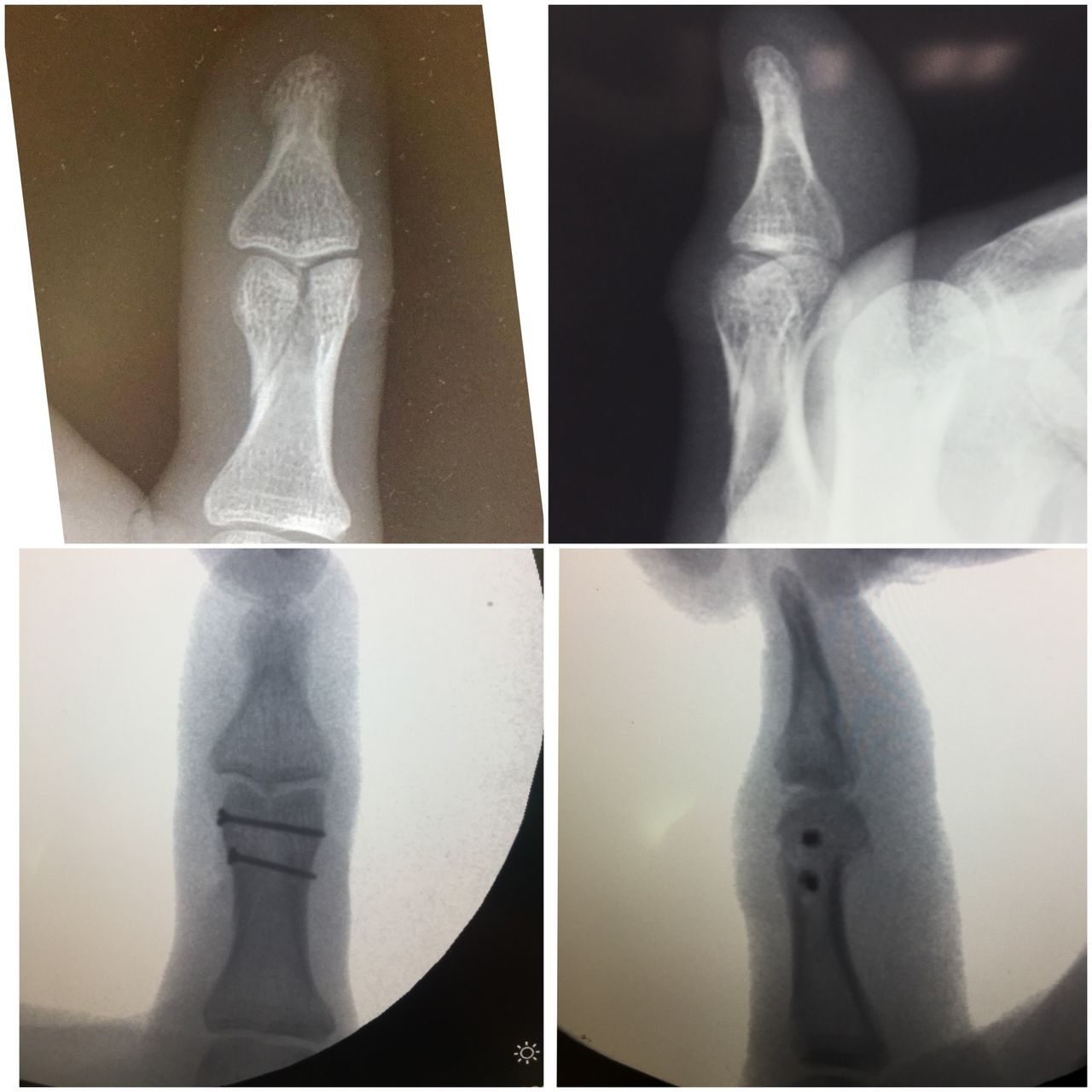 Lucian Lior Marcovici-10