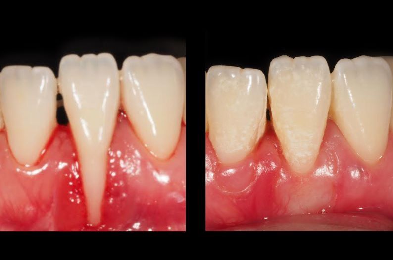 Guillermo Moreno Masiá-16