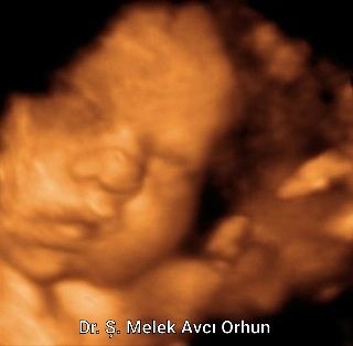 Şahver Melek Avcı Orhun-4