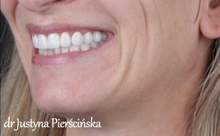 Justyna Pierścińska-7