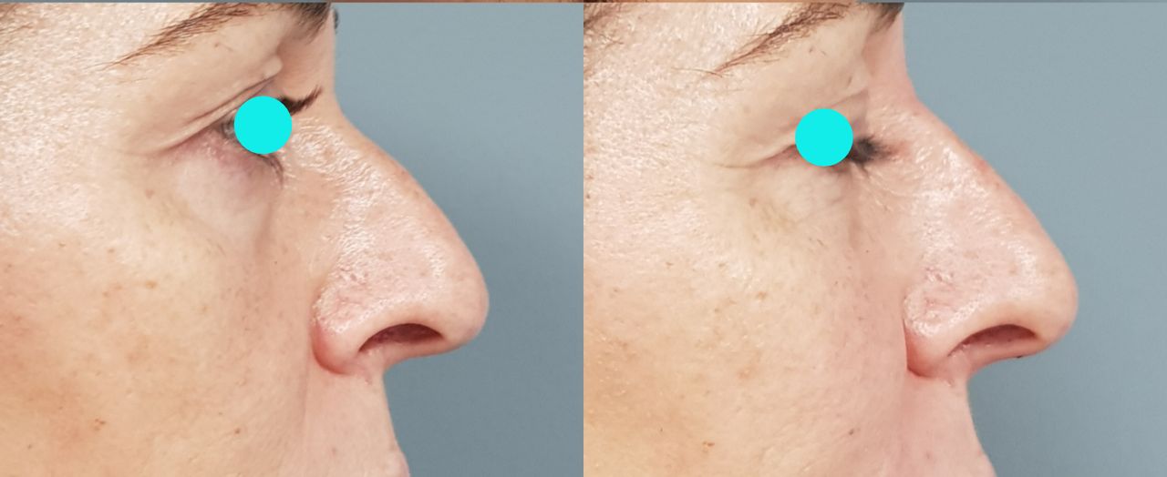 Rosalba Herrero Zerpa-7