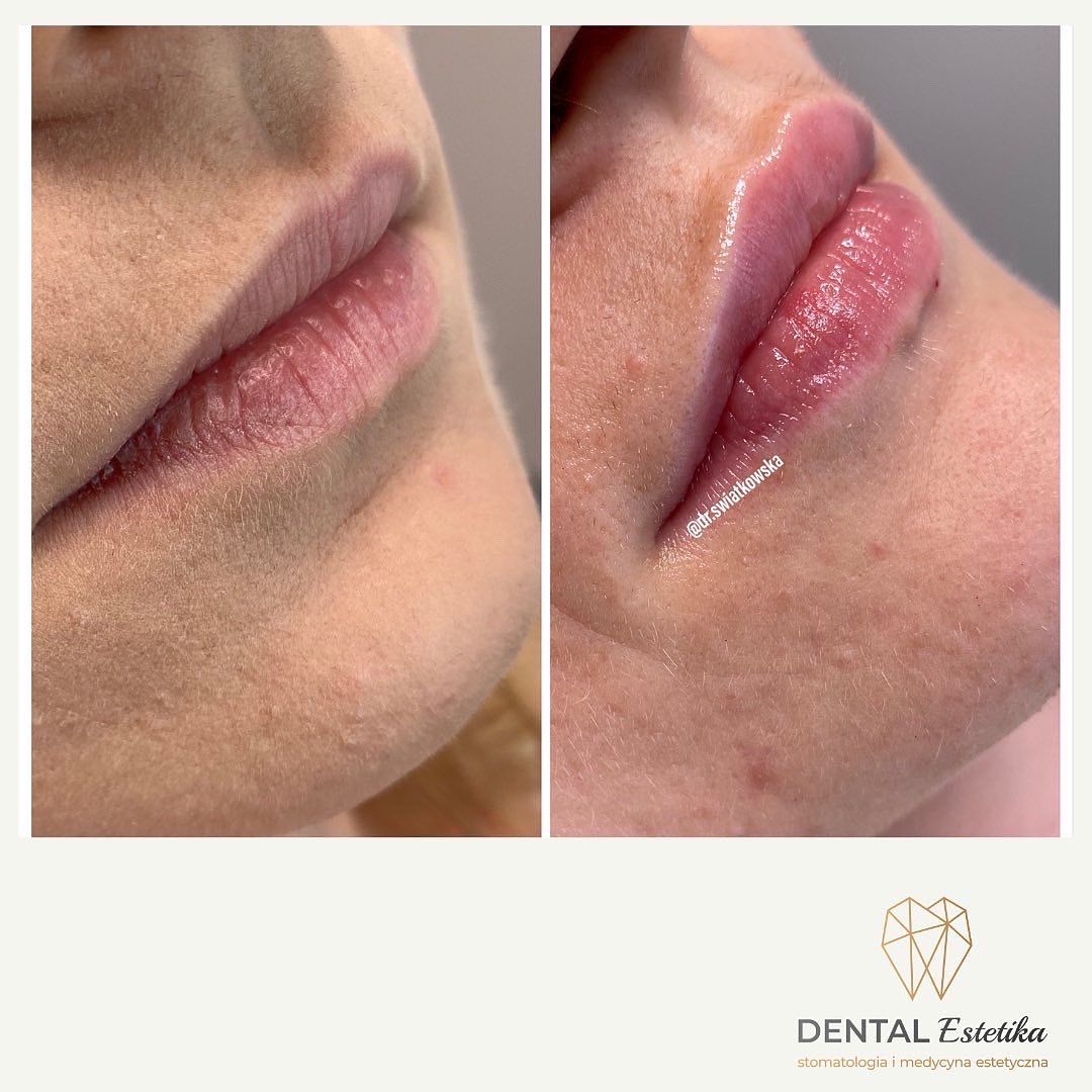 Angelika Świątkowska-34