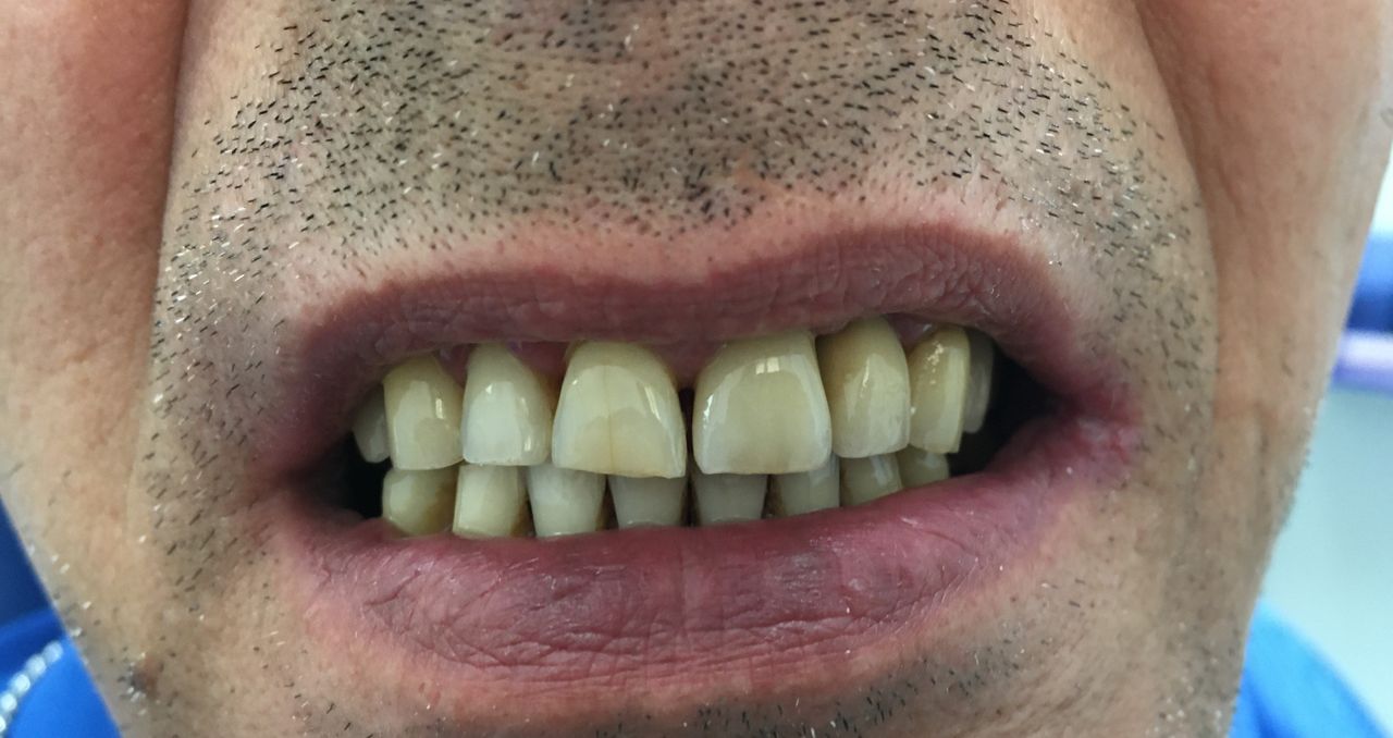 Luigi Aiardo Esposito-2