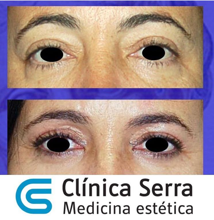 José Maria Serra Mestre-17