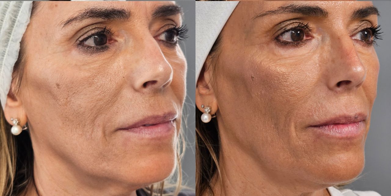 Rosalba Herrero Zerpa-451