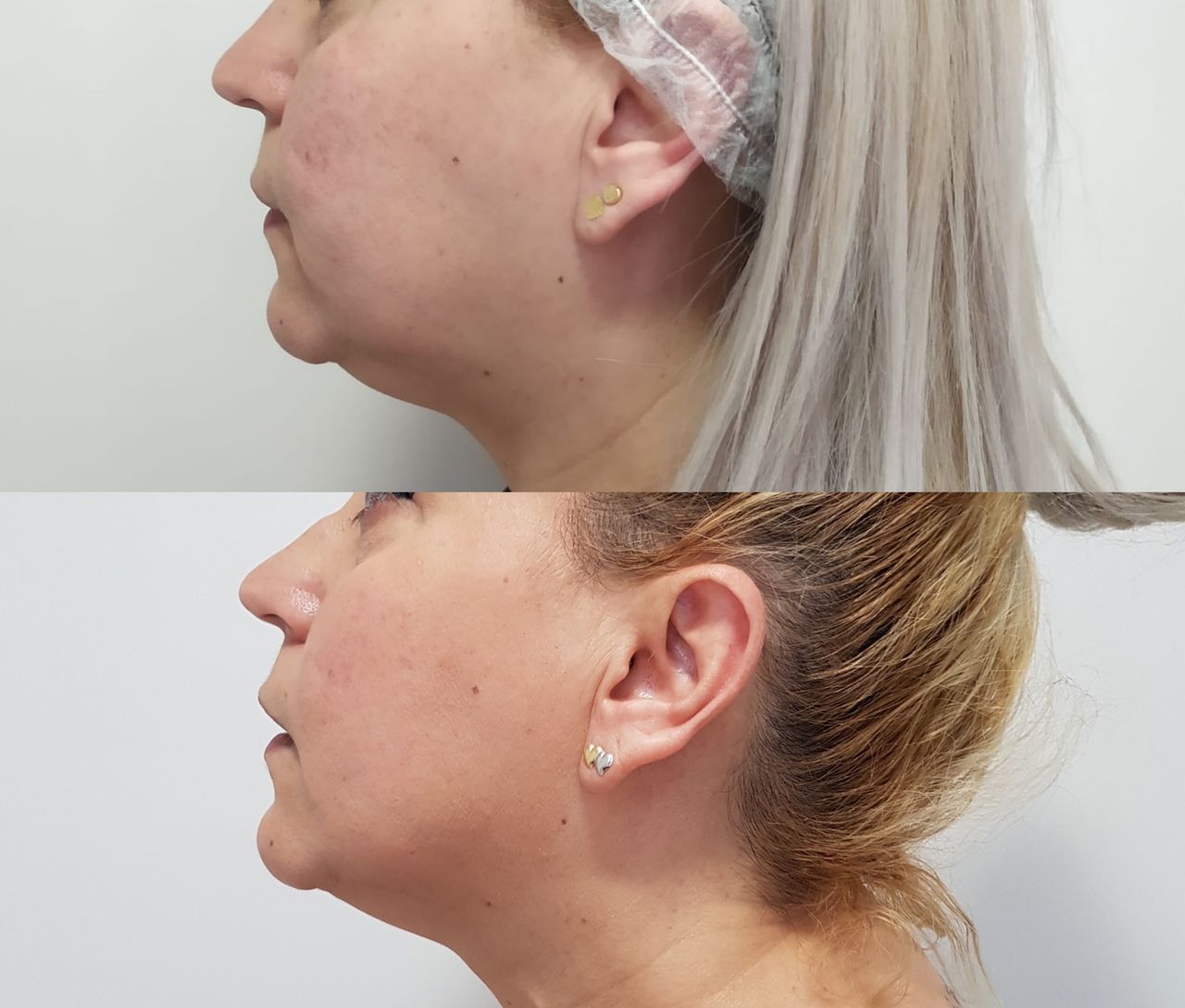 Rosalba Herrero Zerpa-285