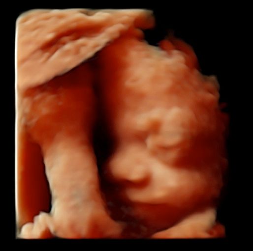 Tommaso Incandela-69