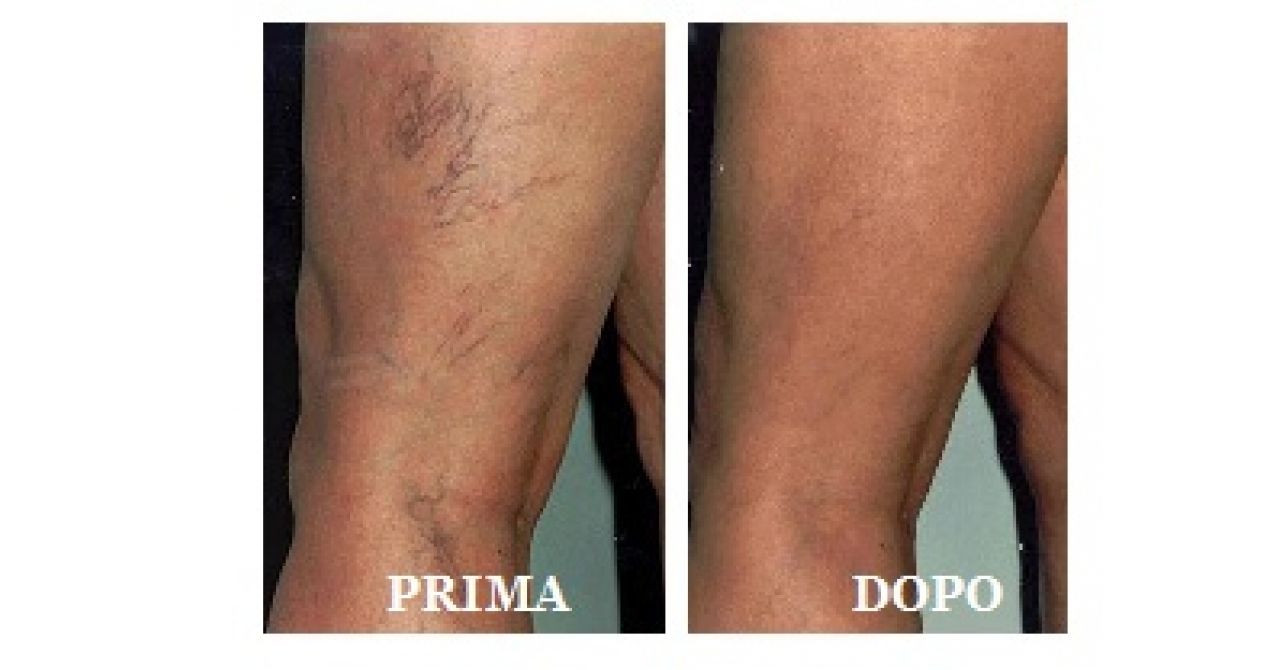 Edoardo Leonardo Rubattu-40