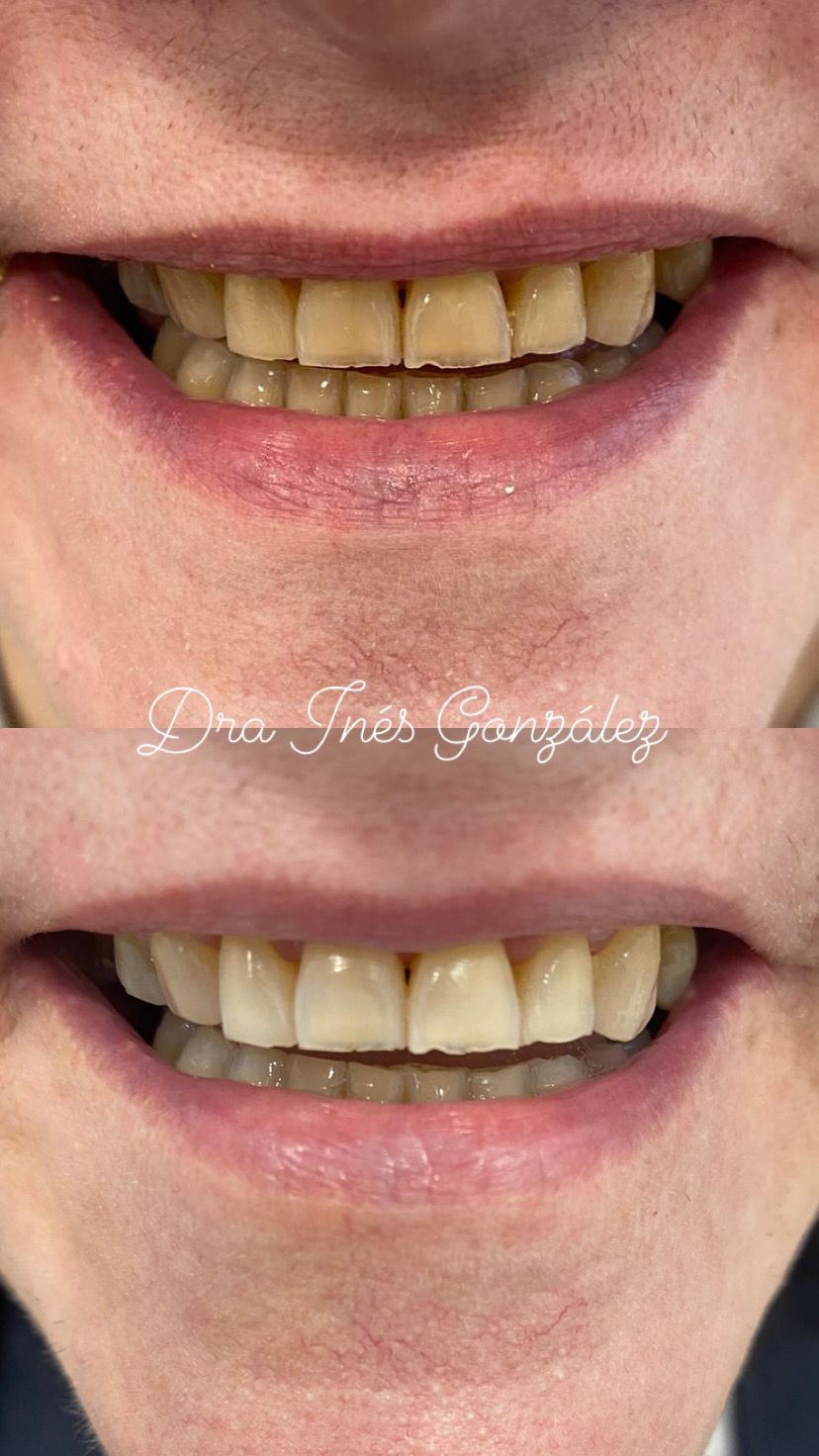 Inés Gonzalez Ordoño-12