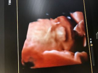 Domenico D'assisi-28