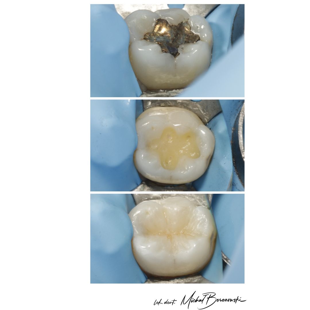 Michał Berezowski-38