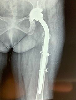 Francesco Augusto Lagrasta-4