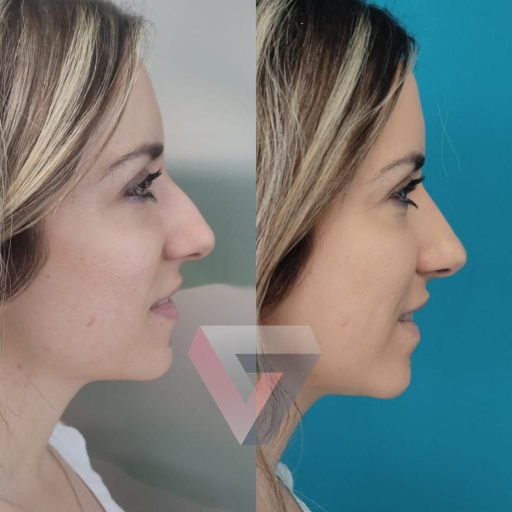 Victoria Trasmonte-53