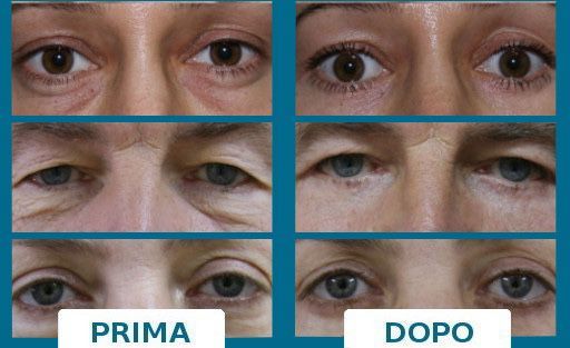 Pasquale Virciglio-32