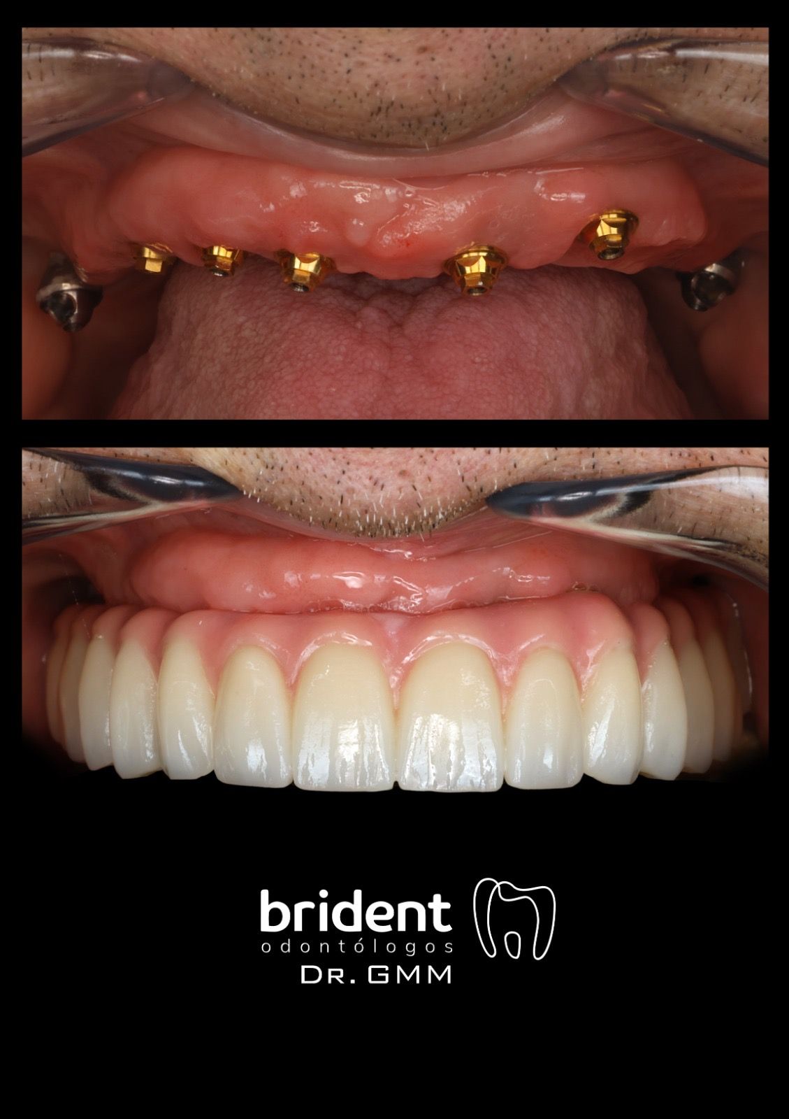 Guillermo Moreno Masiá-69