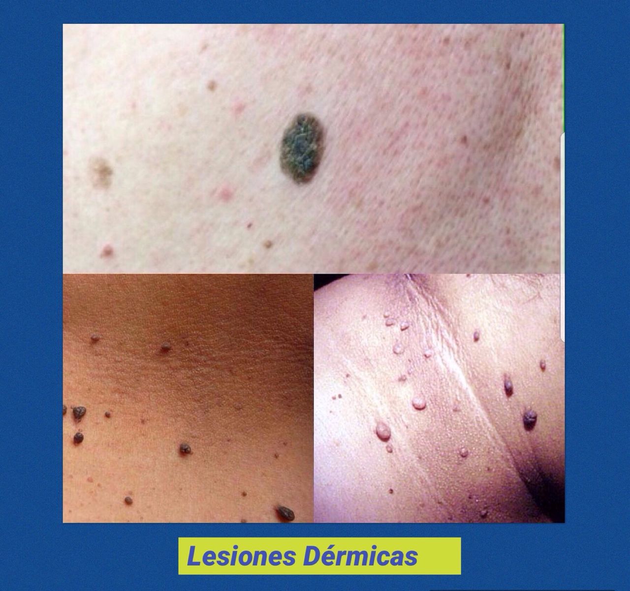 Rosalba Herrero Zerpa-409