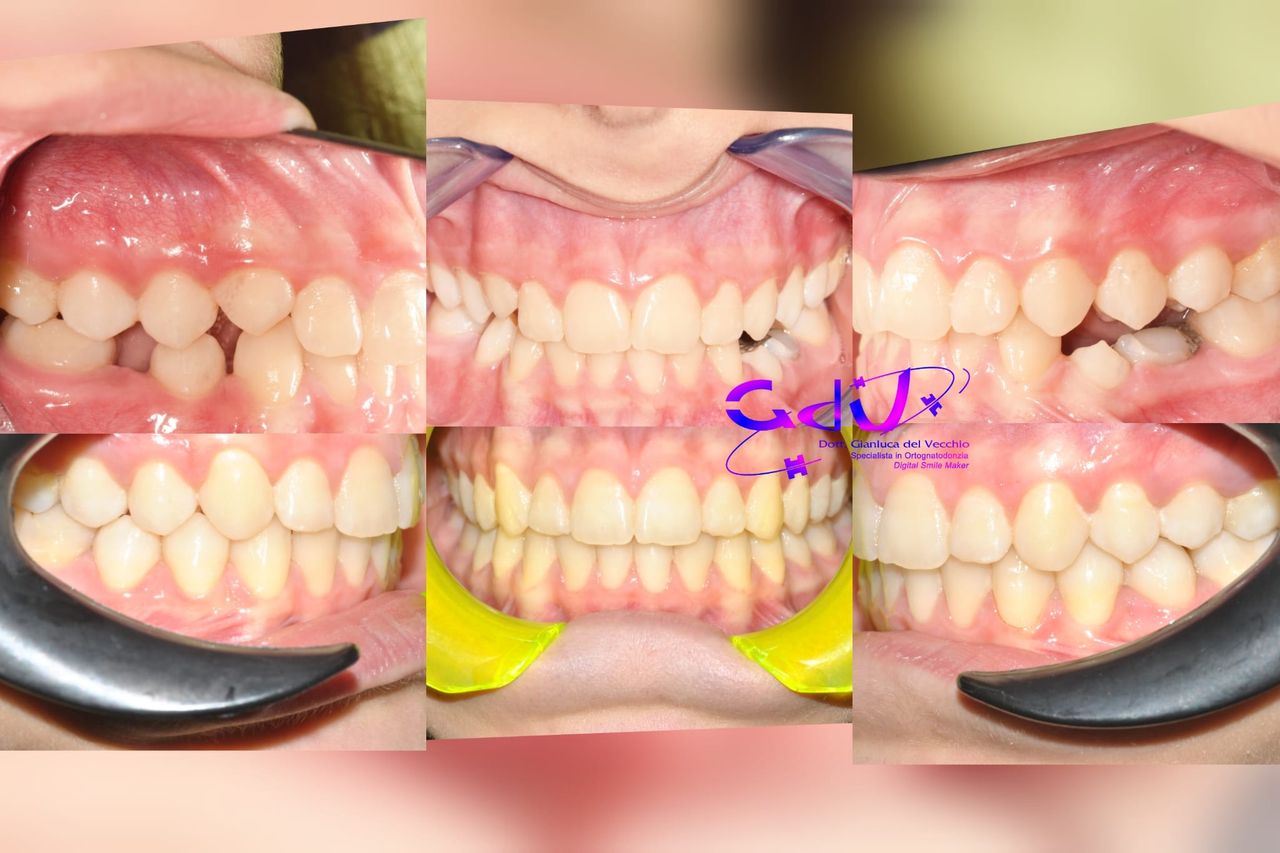 Gianluca Del Vecchio-175