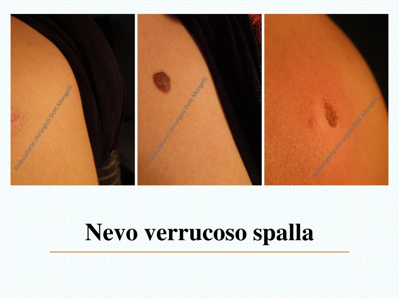 Matteo Antonio Mongelli-23