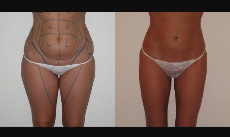 Pasquale Virciglio-31