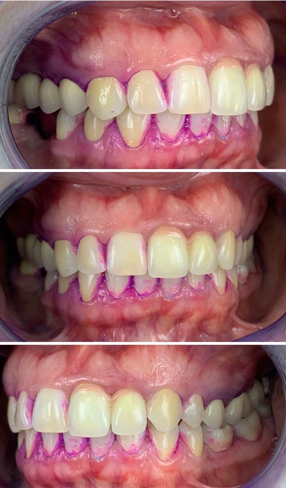 Gianluigi Bittante-87