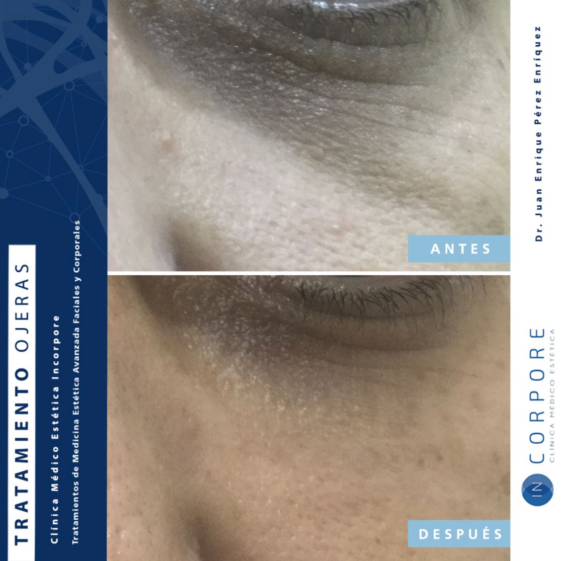 Juan Enrique Pérez Enríquez-93