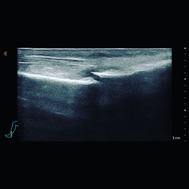 Jacopo Pettinelli-25