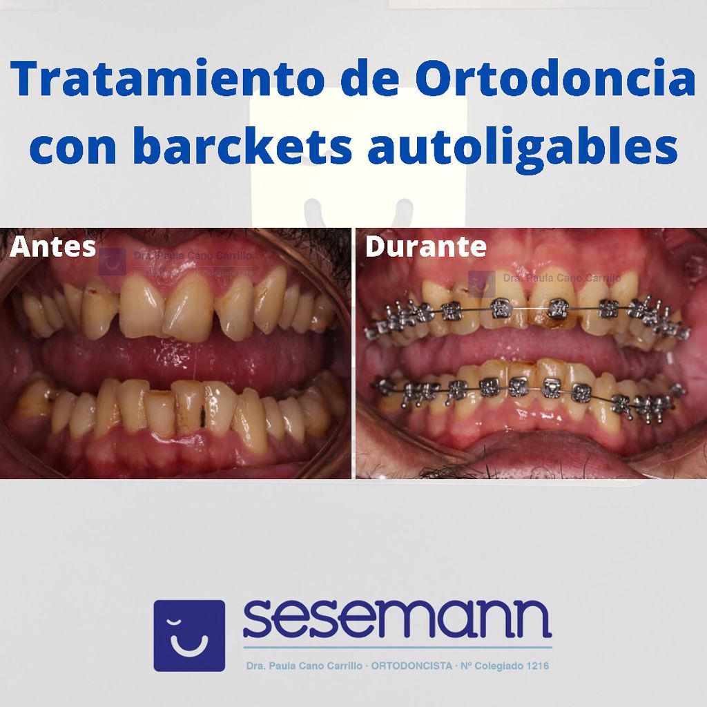 Paula Cano Carrillo-83