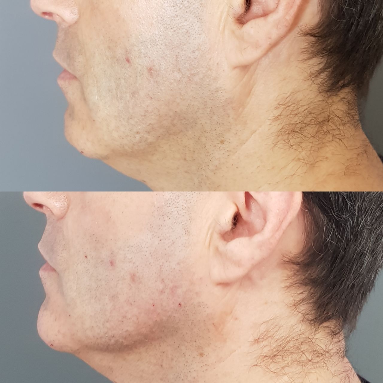 Rosalba Herrero Zerpa-254