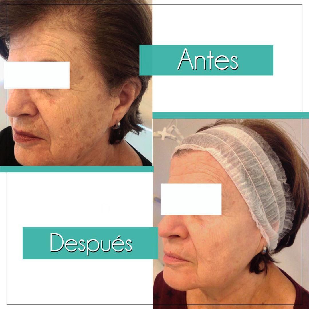 Rosalba Herrero Zerpa-512